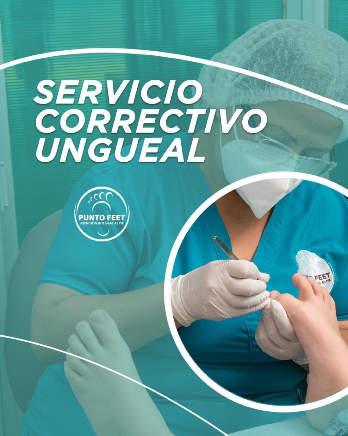 Servicio correctivo ungueal de Punto Feet
